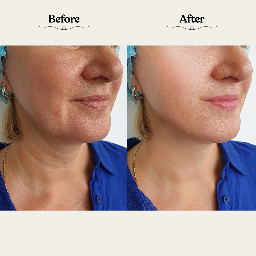 Derma Glow