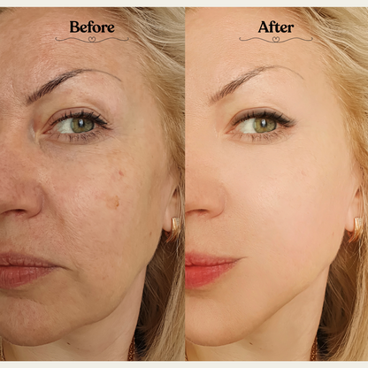 Derma Glow