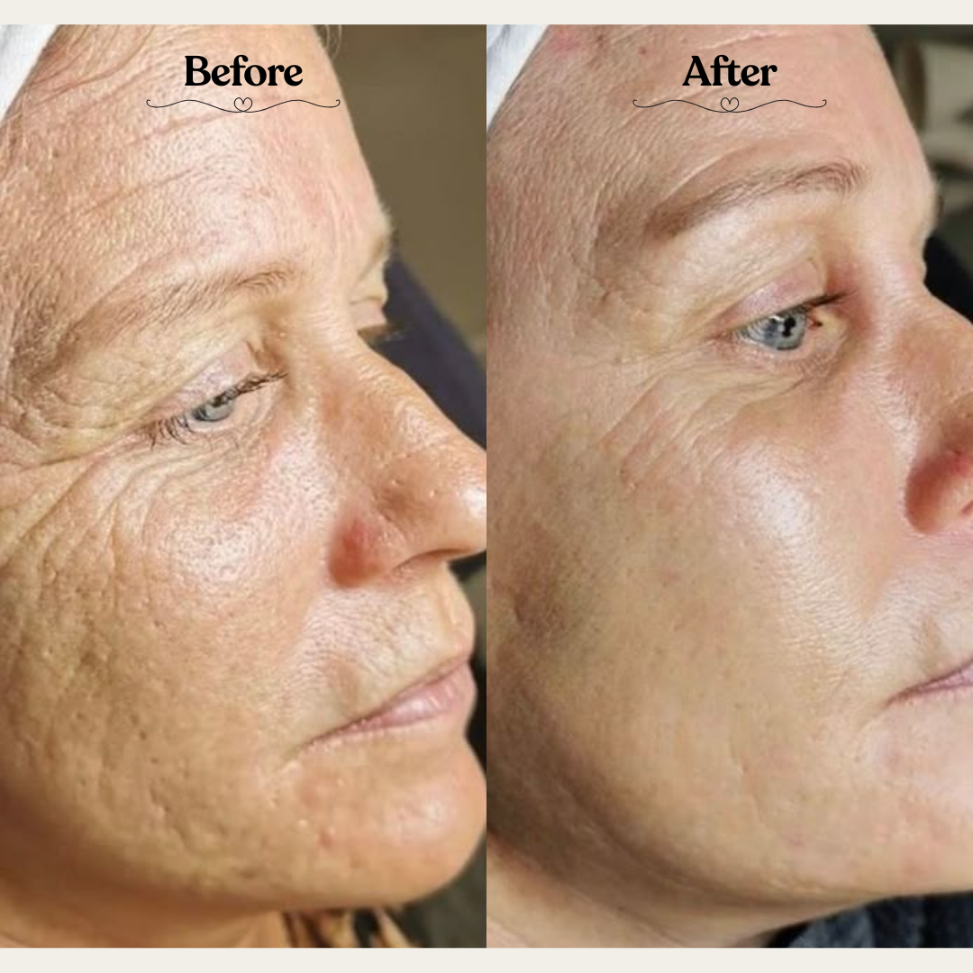 Derma Glow