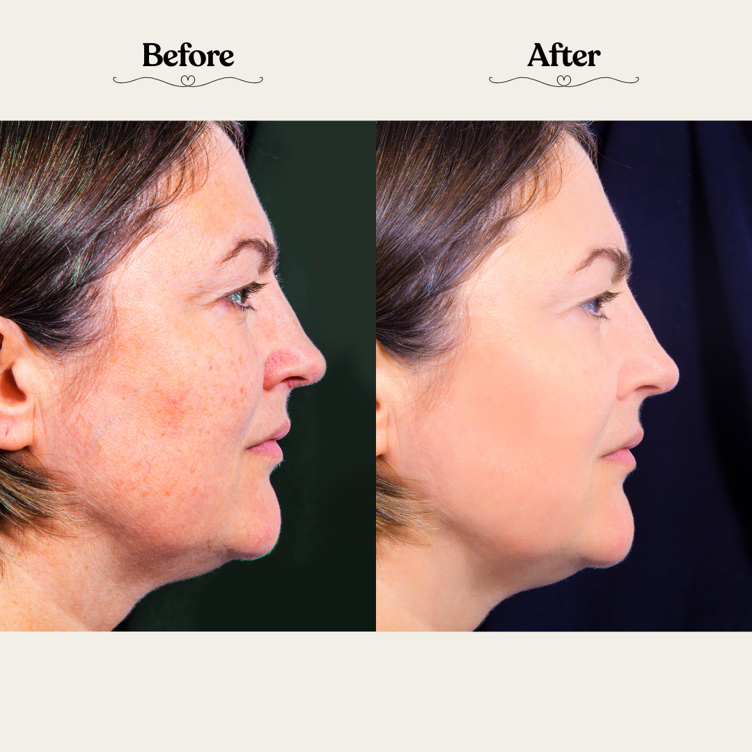 Derma Glow